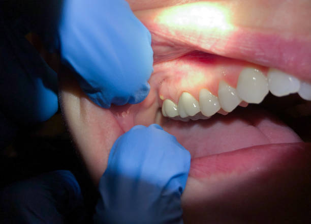 Dentist for Dental Trauma in SC