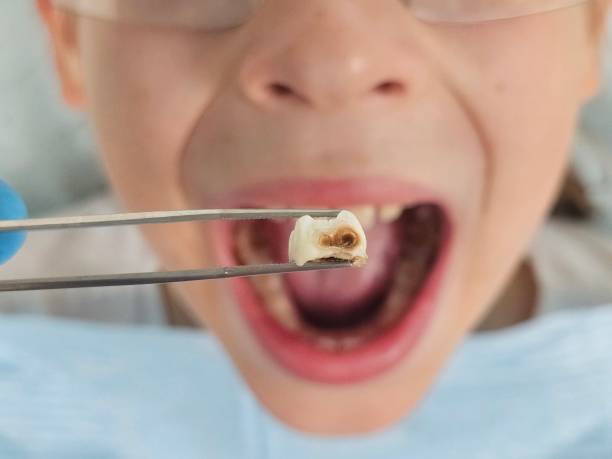Best Knocked-Out Tooth Emergency  in Clover, SC